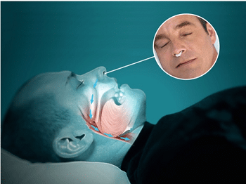 Silent Snore How to use?