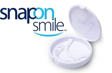 Snap-on Smile O que é isso?